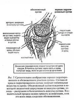 Я выдвинул предположение что опухание и боль в капсуле сустава служат - фото 7