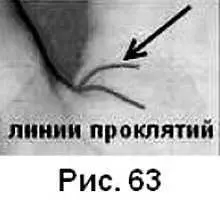 Такую линию можно спутать с короткой линией Марса начинающейся низко к большому - фото 60