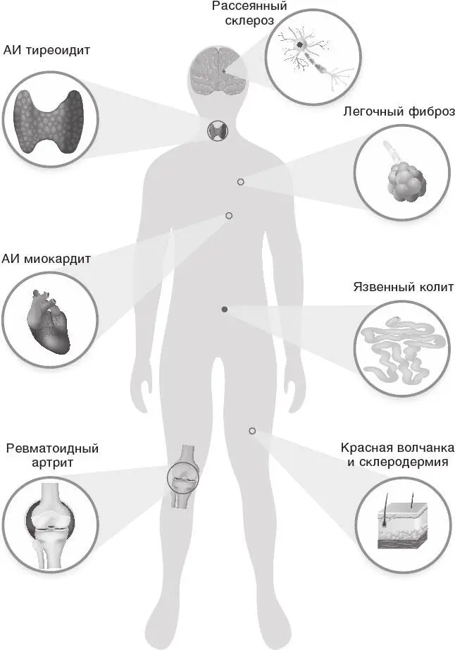 Рис 34 Аутоиммунные заболевания разных органов Ранее считалось что - фото 51