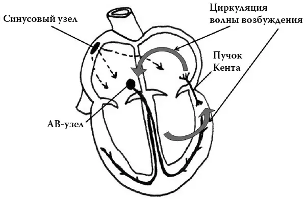 Рис 3 Метод лечения хорошо отработан это радиочастотная абляция попростому - фото 97