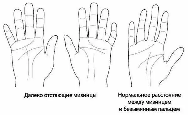 Рис 36 Распознавание далеко отстающего мизинца Таким образом мизинцы - фото 11