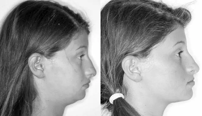 Рисунок 55Данные фотографии наглядно демонстрируют пользу соблюдения - фото 57