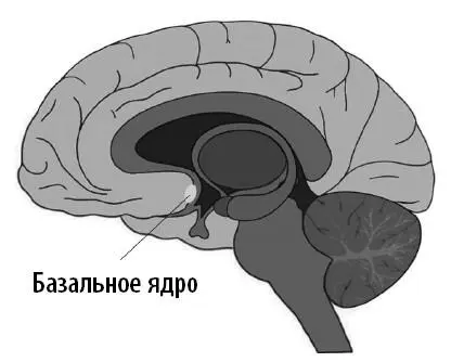Сравнение областей мозга здорового человека и человека с болезнью Альцгеймера в - фото 11