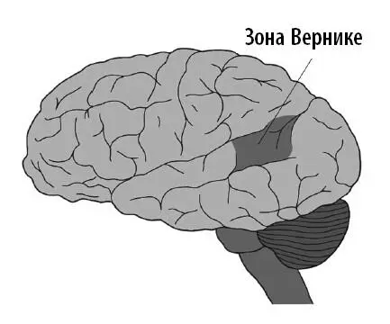 Примерно через 15 лет после того как Леборн впервые пришел к Брока юный - фото 21