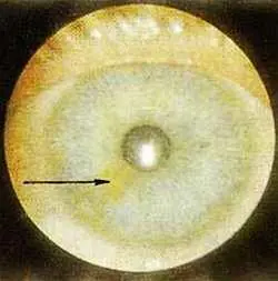 Рис 113 Зарождающийся токсический сектор в проекционной зоне - фото 67