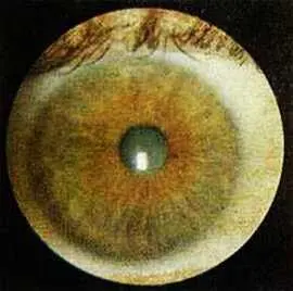 Рис 56 Внутренняя гетерохрония различили окраска зрачкового и цилиарного - фото 51