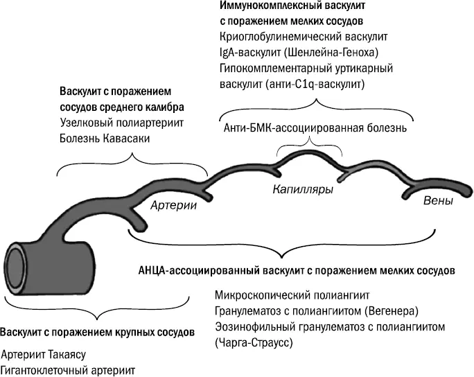 Схема 1 Классификация системных васкулитов почек Гигантоклеточный артериит - фото 2
