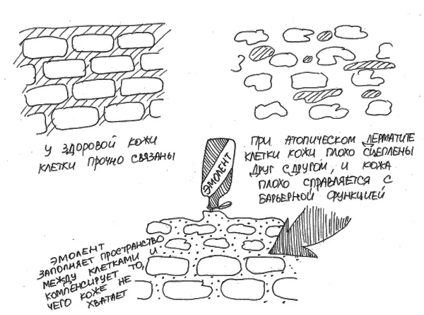 Рис 20 Зачем нужны эмоленты при атопическом дерматите Уход за кожей важен не - фото 20