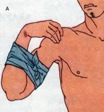 Рис 19 Остановка кровотечения с помощью сгибания конечностей Рис 20 - фото 25