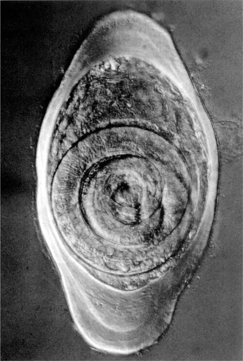 Trichinella вызывающая трихинеллез является исключительным паразитом это - фото 10