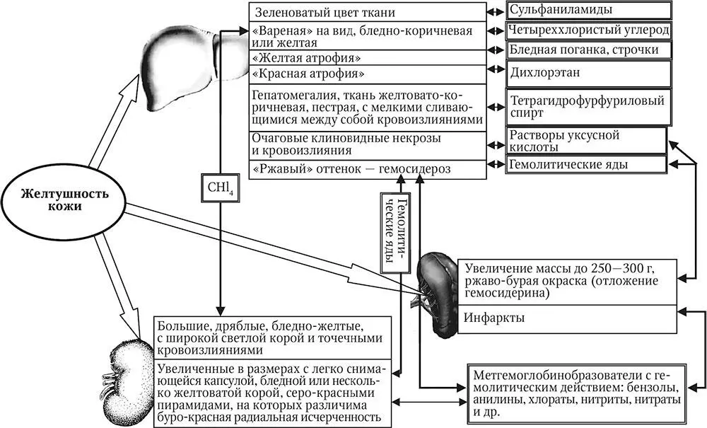 Рис 2 Морфологические изменения в паренхиматозных органах при некоторых - фото 8