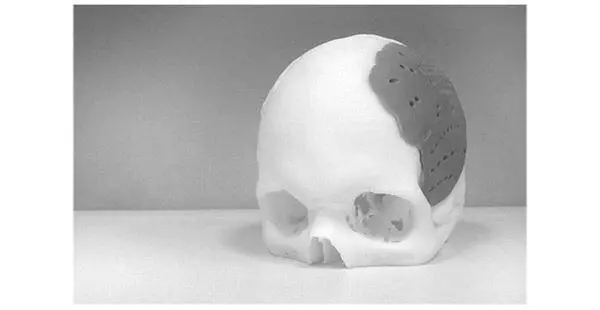 Рисунок 511 3Dпечать уже используется для получения имплантатов - фото 61