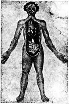 Aderlaßfigur aus dem XV Jahr Nach Sudhoff Augenquerschnitt 1539 Nach - фото 14