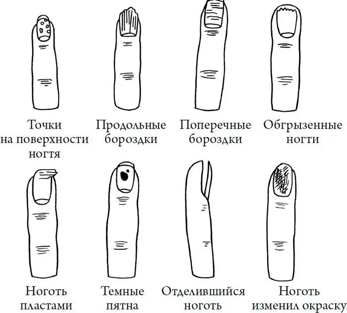 Человек Противный Зачем нашему безупречному телу столько несовершенств - изображение 160