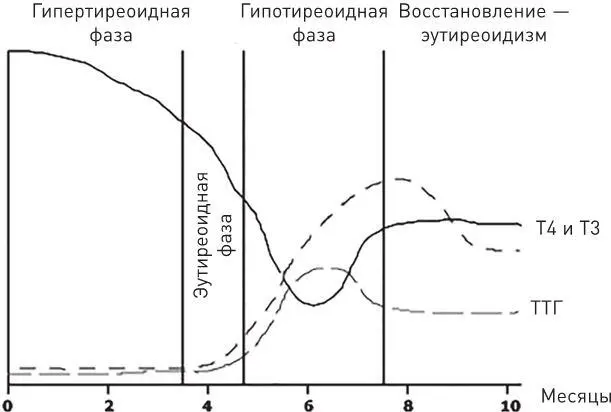 Рис 11Фазы послеродового тиреоидита Как это выявить Какие анализы сдать - фото 77