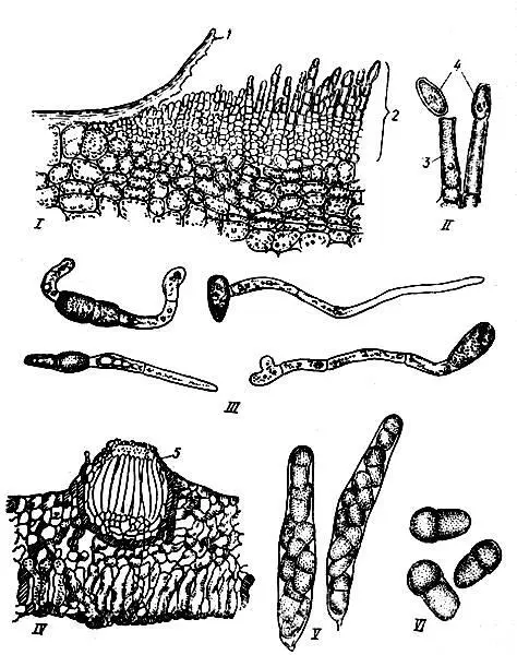 Рис 3 Микроскопическая картина сумчатой Venturia inaequalis Cke Wint и - фото 3