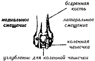 Рис 112 Смещение коленной чашки КОЛЕННЫЙ СУСТАВ КОЛЕНОStifle Син knee - фото 113
