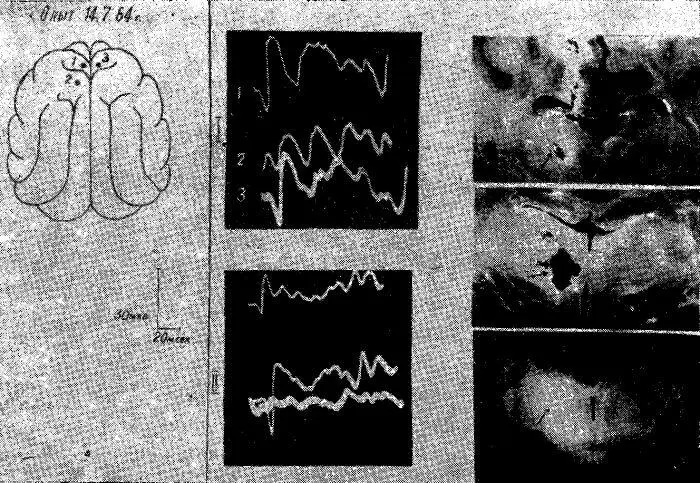 Рис 16 Изменения распространения соматосензорного вызванного потенциала по - фото 74