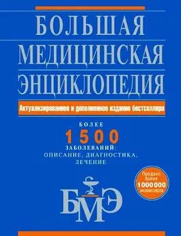 Коллектив авторов Медицина - Большая медицинская энциклопедия. Более 1500 заболеваний: описание, диагностика, лечение