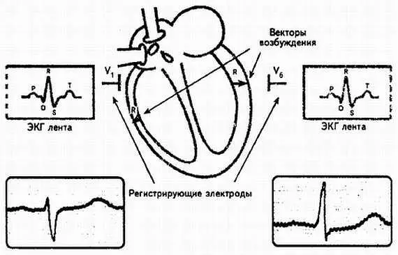 Рис 92 Схематическое изображение возбуждения нормального миокарда При - фото 92