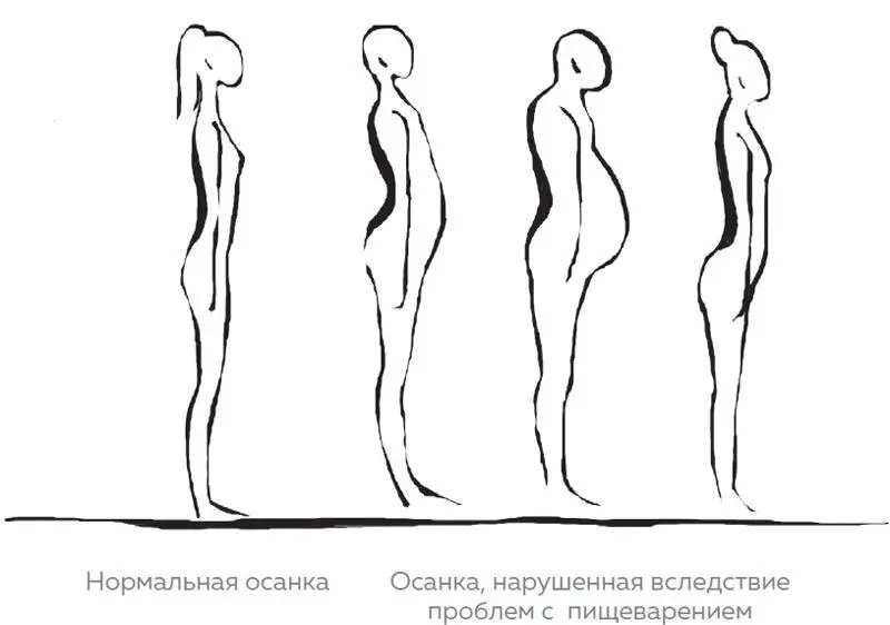 Рис 4 Виды нарушенной осанки Связь которую легко проследить во многих - фото 113