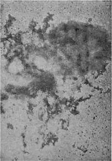 Распадение бактерии дизентерии под действием бактериофагов через 30 минут - фото 12