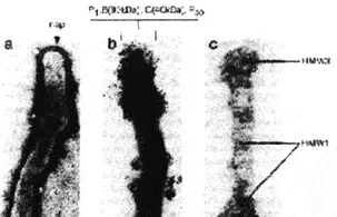 Рис 14 Концевая структура органеллы участвующей в адгезии микоплазмы - фото 14