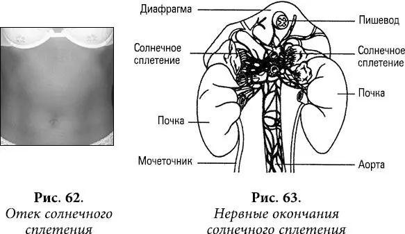 Собственно это и будет картина обычного сосудистомышечного гипертонуса - фото 51