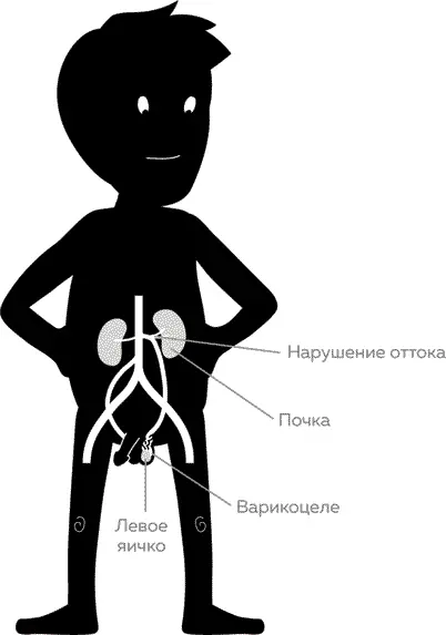 По левой стороне тела кровь от яичек течет в левую почечную вену Сосуд впадает - фото 7