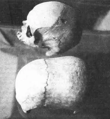 Рис 125 Найденные на Мальте долихоцефалические черепа Медицинские эксперты - фото 86