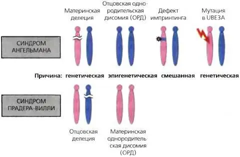Рис 233Синдром ПрадераВилли и синдром Ангелмана Оба синдрома могут быть - фото 231