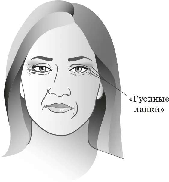 Золотой стандарт Ботокс Бесспорно лучший способ борьбы с гусиными лапками - фото 22