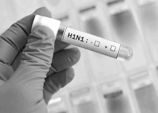 Вирус Н1N1 Медики до сих пор не могут определить где именно мог находиться - фото 92
