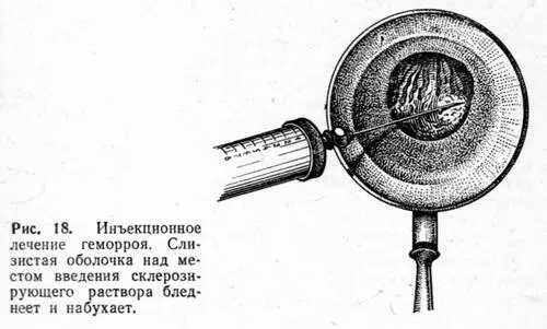 После инъекций стул специально задерживать не нужно Обычно при хорошей - фото 25