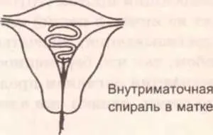 Презерватив Правильно надетый презерватив должен иметь свободное место на - фото 91