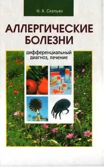 Николай Скепьян - Аллергические болезни: дифференциальный диагноз, лечение