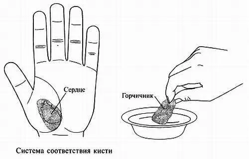 Рис 101 Постановки горчичника на зону соответствия сердцу при болях в сердце - фото 95