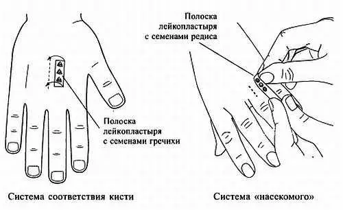 Рис 104 Семянотерапия при болях в пояснице Если есть мокса или полынная - фото 98
