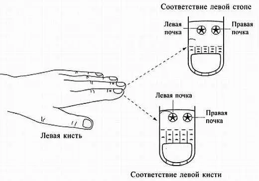 Рис 132 Применение металлических звездочек в минисистемах для лечения - фото 125