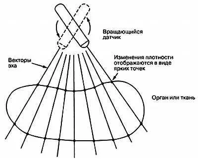 Рис 1031 Работа секторного сканера в Врежиме Каждое возвращающееся эхо - фото 289