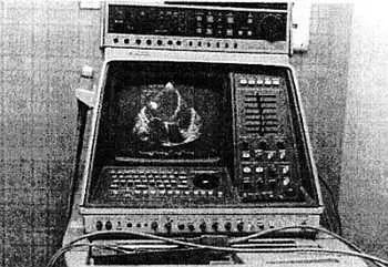 Рис 1033 Типичный секторный сканер для эхокардиографии Все эти приборы - фото 291