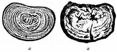 Горизонтальный разрез нормального межпозвонкового диска а и диска с - фото 27