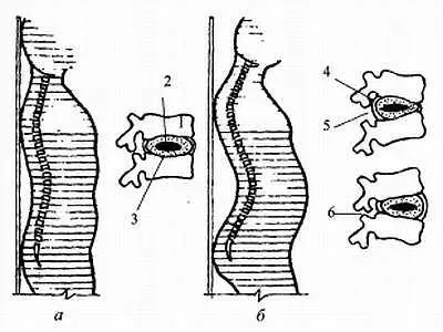 Положение позвоночного столба а норма патология 1 позвонок 2 - фото 28