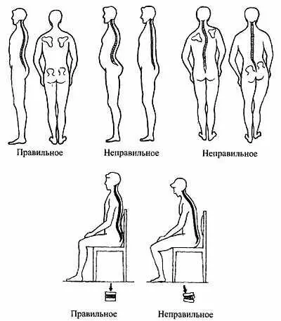 Положение позвоночного столба Поднятие тяжестей Давно известно что у - фото 29