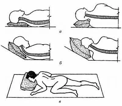 Положение тела во время сна а правильное б неправильное в поза - фото 31