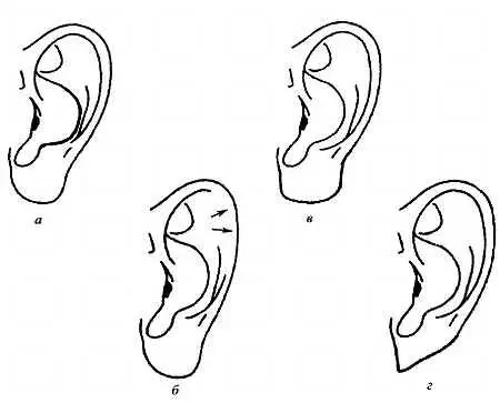 Форма ушей подсказывает заболевания И всегото какихто 35 минут надо - фото 40