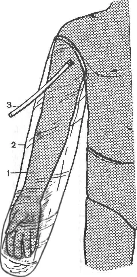 Рис 7 Пневматическая надувная шина для иммобилизации верхней конечности - фото 7