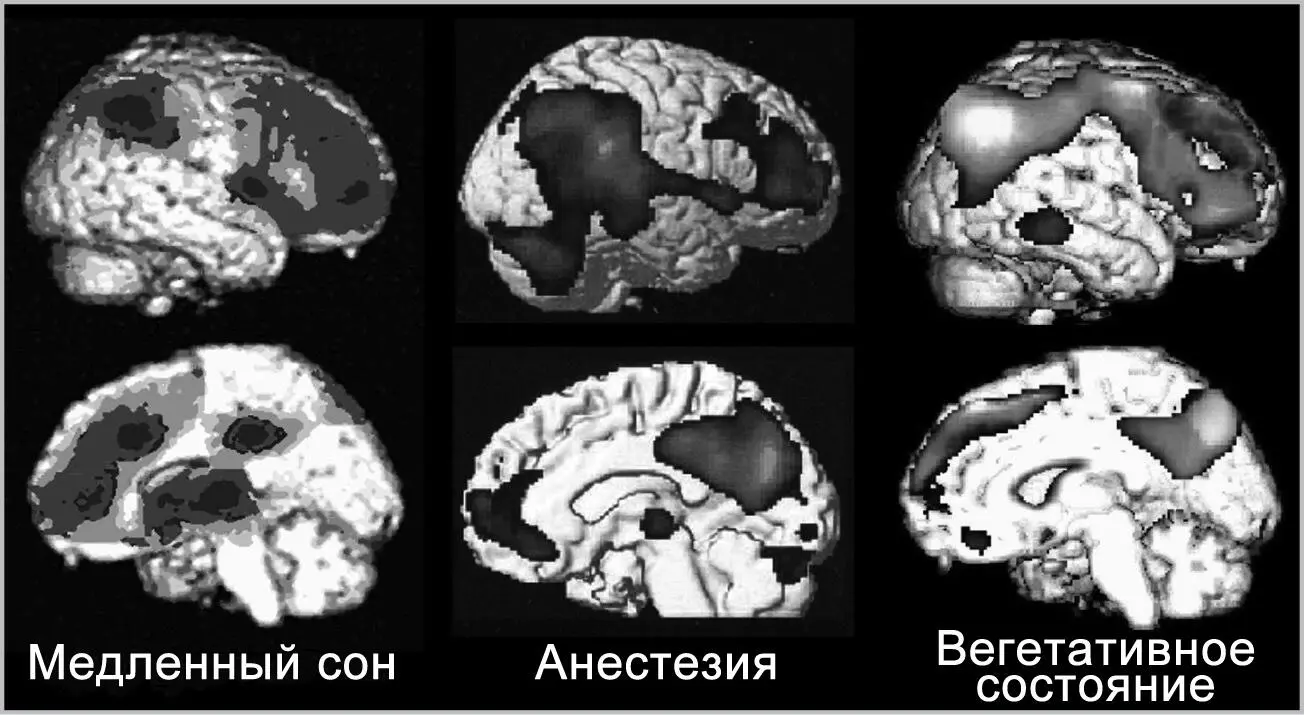 Рисунок 32Бессознательному состоянию сопряженному с медленным сном - фото 35