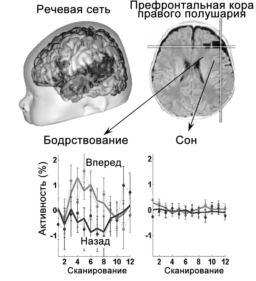Рисунок 34У бодрствующего маленького ребенка префронтальная кора уже проявляет - фото 37