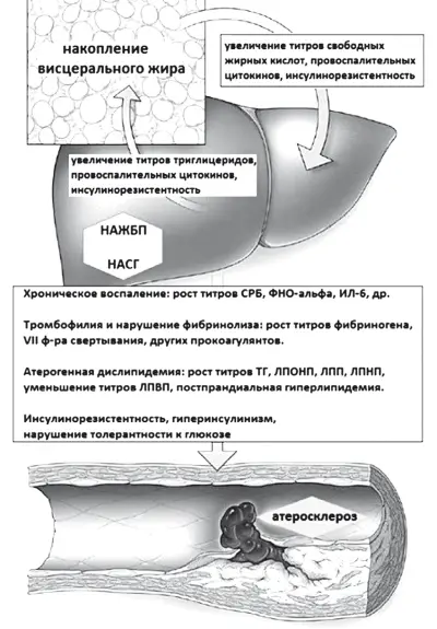 Рис 32 Проатерогенные эффекты НАЖБП модифицировано по Targher G et al - фото 35